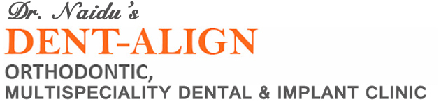 Dent-Align